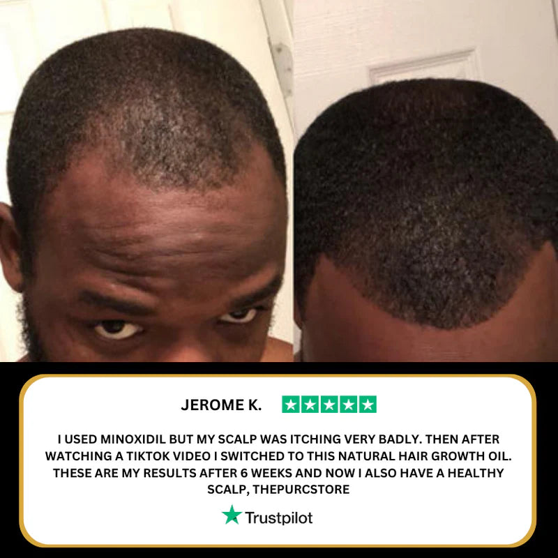 Natural Hair Growth Oil