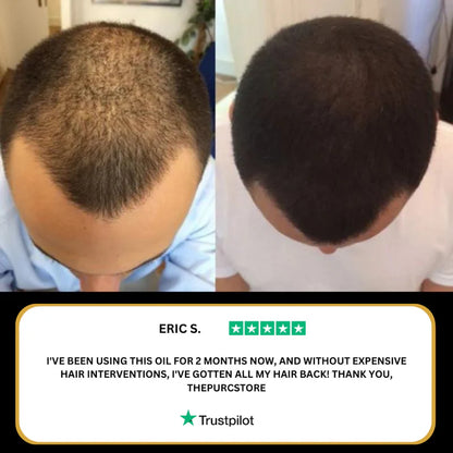 Natural Hair Growth Oil